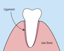 tooth extractions in alexandria va